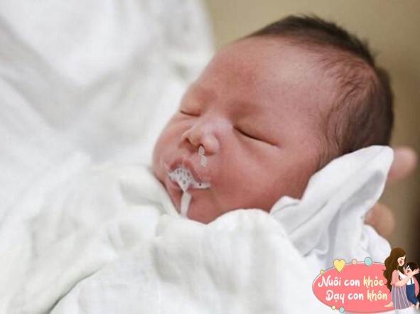 Có 3 giai đoạn trẻ sơ sinh “khó nuôi”, mẹ lưu tâm để con không bị ốm - 5