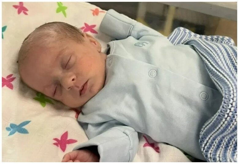 Em bé chào đời khiến bác sĩ bất ngờ với làn da đỏ ửng như bị bỏng - 3