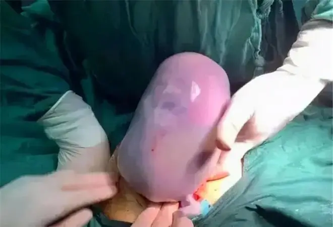 Bà mẹ 9X sinh con nhìn như “thạch rau câu”, chồng hoảng sợ nhưng bác sĩ lại chúc mừng - 2