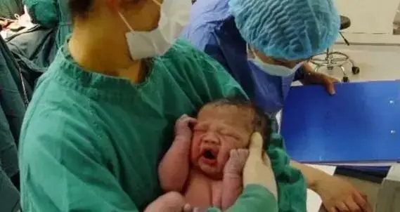 Bà mẹ 9X sinh con nhìn như “thạch rau câu”, chồng hoảng sợ nhưng bác sĩ lại chúc mừng - 3