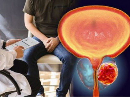 Công nghệ - Giới khoa học tìm ra cách kìm hãm một trong những căn bệnh ung thư nguy hiểm nhất