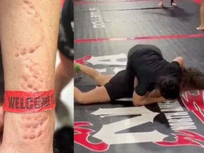 Thể thao - &quot;Suarez nữ&quot; khiến làng võ phẫn nộ, cắn đối thủ &quot;không trượt phát nào&quot;