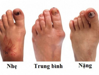 Thông tin doanh nghiệp - Thói quen ai cũng mắc phải khiến xương khớp “xuống cấp” không phanh