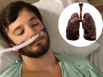 Thông tin doanh nghiệp - 5 “kẻ thù không đội trời chung” của phổi, lập tức tránh xa nếu không muốn tương lai phải thở máy