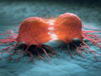 Y tế - Những hiểu lầm tai hại về nguyên nhân gây ung thư