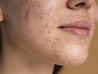 Thông tin doanh nghiệp - Những dịch vụ da liễu được quan tâm nhất năm 2025: Bạn nên chọn gì khi đến phòng khám?