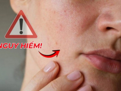 Thông tin doanh nghiệp - Thấy 3 dấu hiệu lạ trên mặt, chuyên gia khuyên nên đi khám phổi kịp thời