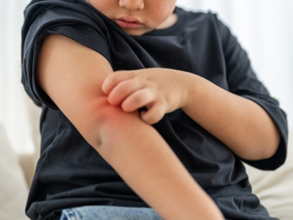 Thông tin doanh nghiệp - Bỏ quên mũi tiêm nhắc lại, con có thể mang di chứng suốt đời vì viêm não Nhật Bản