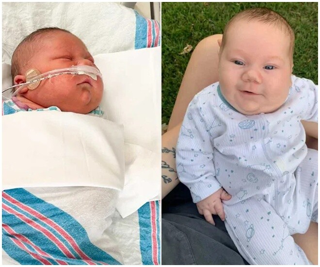 Một năm sau ngày mất con, người mẹ đón “em bé cầu vồng” nặng gần 6kg khiến cả bệnh viện kinh ngạc - 1