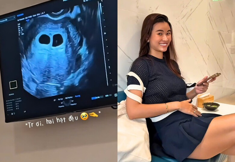 Người đẹp Hải Phòng bầu song thai, hoang mang vì cứ 3 ngày lại tăng 1kg, đặt tên cho con nghe đã thấy &#34;say&#34; - 3
