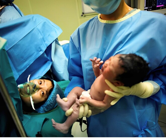 Bác sĩ đang khâu vết mổ đẻ, sản phụ 36 tuổi bất ngờ hét lên 1 câu giúp cô giữ được mạng sống - 1