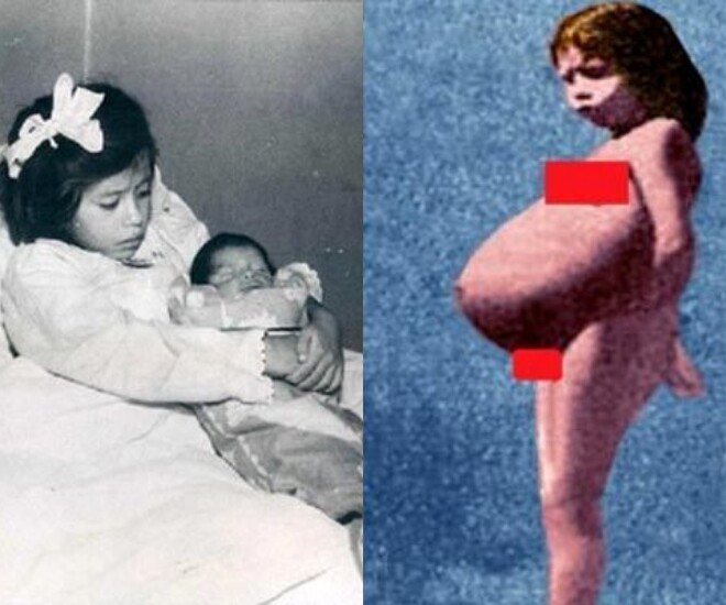 Cô bé 5 tuổi sinh con gây chấn động thế giới và bí ẩn chôn vùi cho đến hiện tại - 1