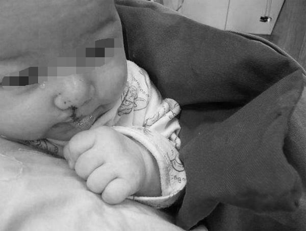 Em bé sinh ra có ngoại hình biến dạng, bác sĩ đưa ra lý do liên quan đến thói quen của chồng khi vợ mang bầu - 2