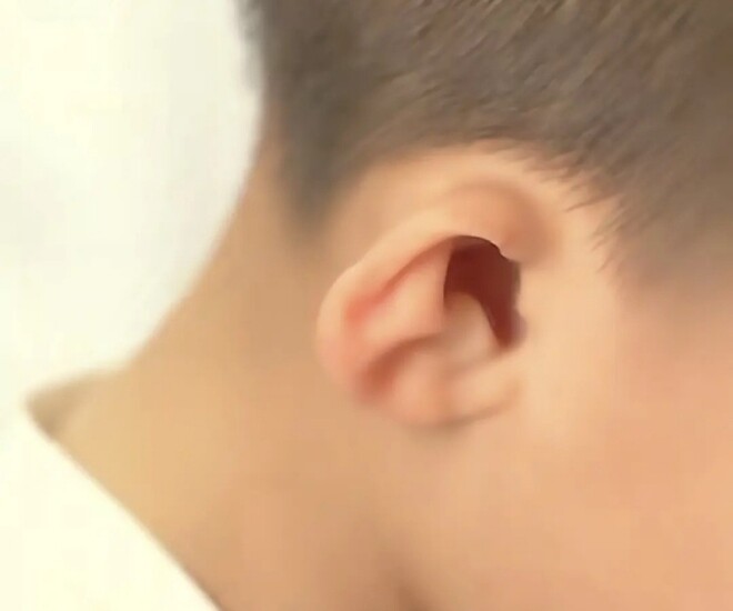 Em bé sinh ra có ngoại hình biến dạng, bác sĩ đưa ra lý do liên quan đến thói quen của chồng khi vợ mang bầu - 1