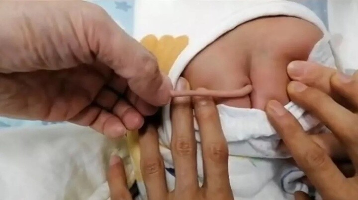Nữ sinh 19 tuổi sinh con có ngoại hình khác lạ, chồng trẻ hoảng loạn khi nhìn thấy em bé, đưa đi xét nghiệm ADN - 3