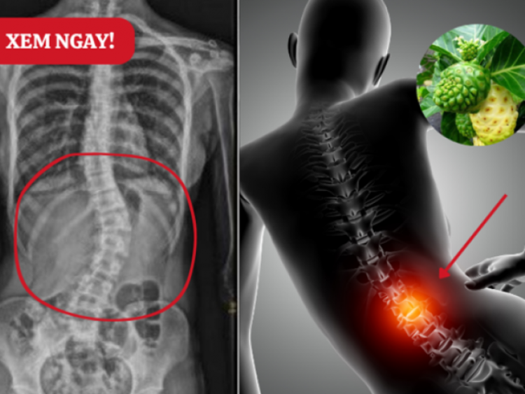 Thông tin doanh nghiệp - Ngồi lâu đau nhức muốn “gãy lưng”, đau âm ỉ mãi không dứt – Đừng bỏ qua mẹo đơn giản này!